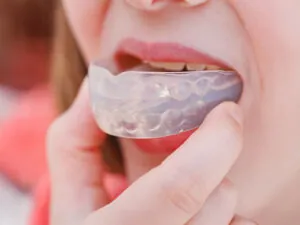 Snoring Prosthesis