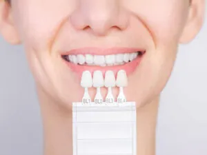 Zirconium Restorations